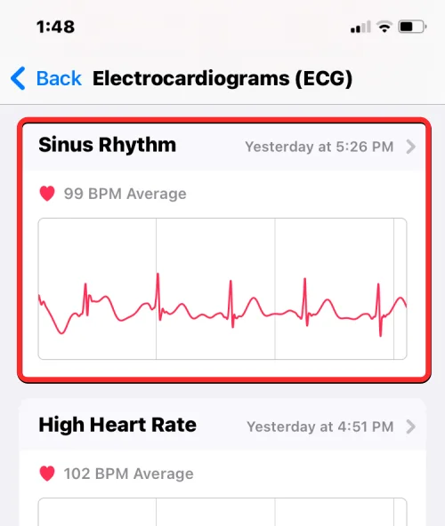 Ta opp EKG på Apple Watch: Trinn-for-trinn-veiledning