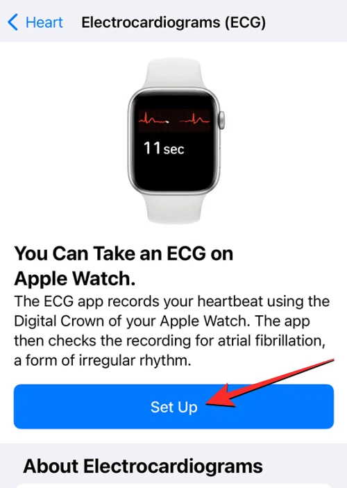 Ta opp EKG på Apple Watch: Trinn-for-trinn-veiledning
