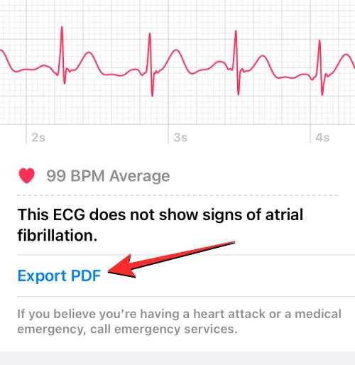 Ta opp EKG på Apple Watch: Trinn-for-trinn-veiledning