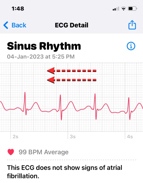 Ta opp EKG på Apple Watch: Trinn-for-trinn-veiledning