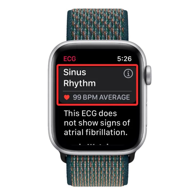 Ta opp EKG på Apple Watch: Trinn-for-trinn-veiledning
