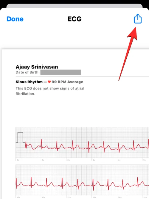 Ta opp EKG på Apple Watch: Trinn-for-trinn-veiledning