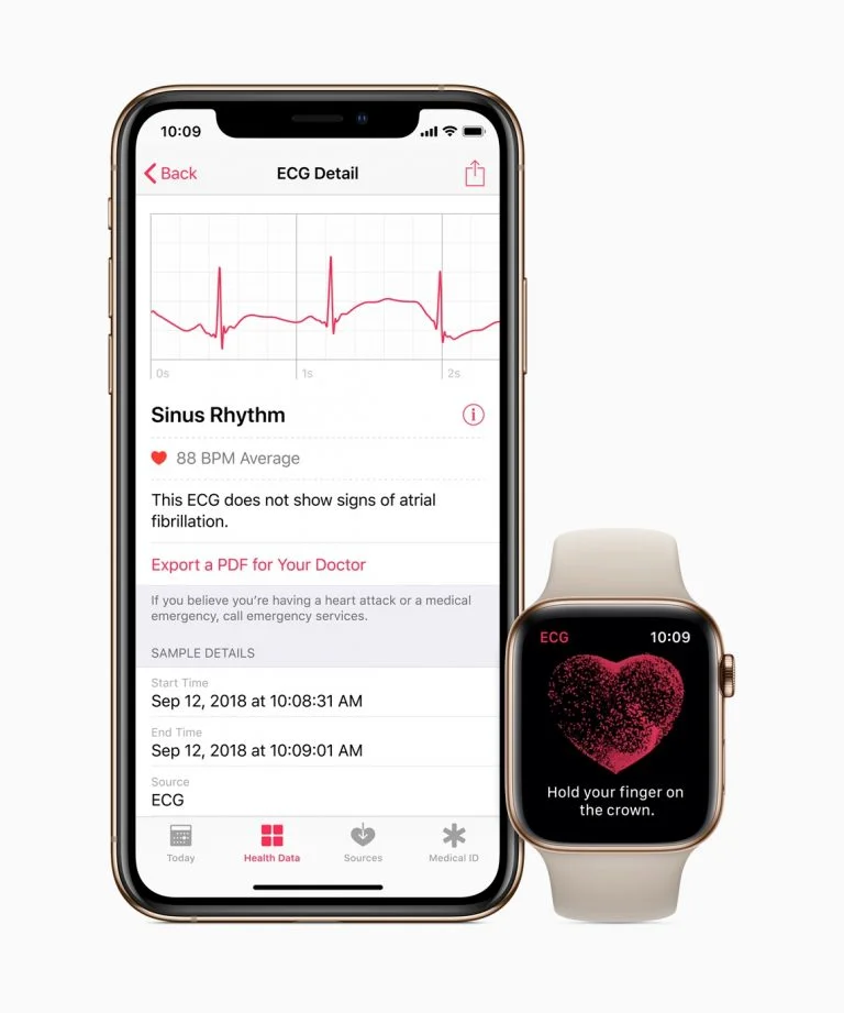 Kaip naudoti EKG programą „Apple Watch Series 4“.